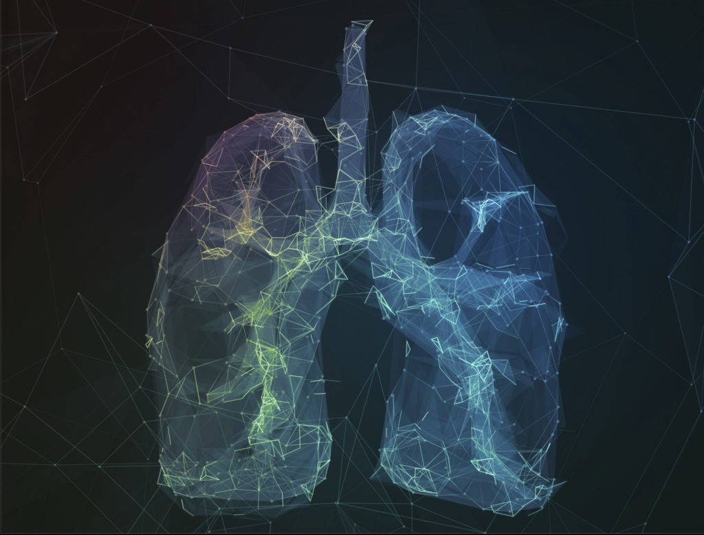 Low-dose CT Lung Cancer Screening - TRA Medical Imaging