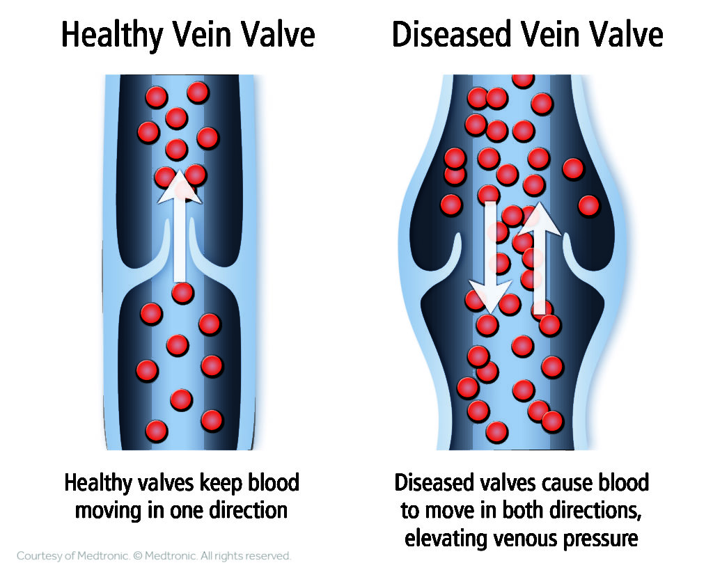 Vein and Vascular - TRA Medical Imaging