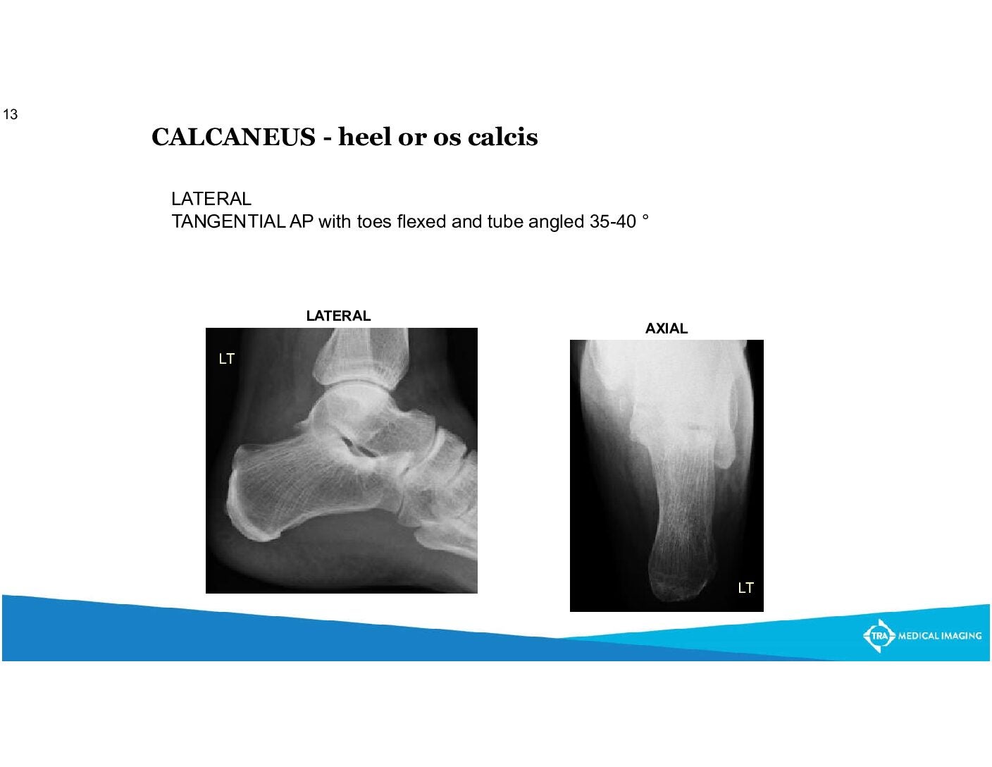 Film Ankle Xray Radiograph Showing Heel Stock Photo 1490402393 |  Shutterstock