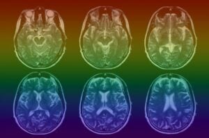 Rainbow gradient MRI Brain