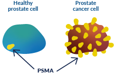 PSMA Cells